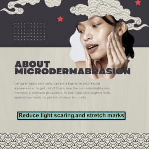 getting microdermabrasion